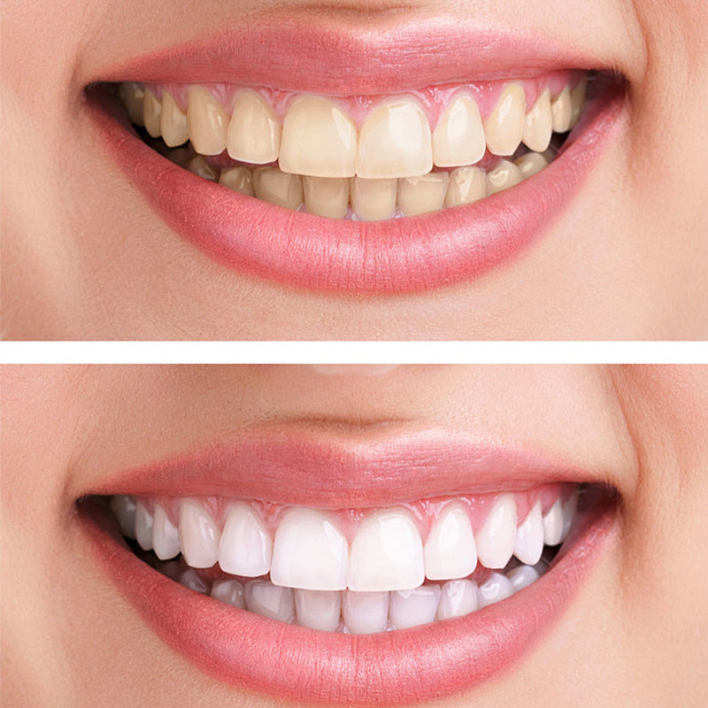 Dentifricio all'idrossiapatite