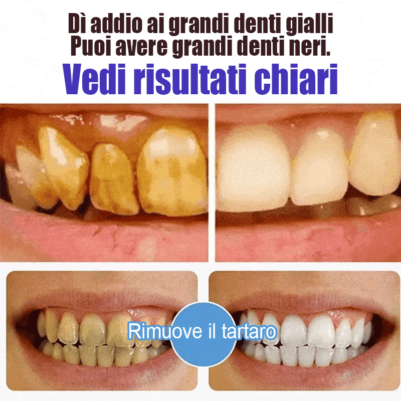 Dentifricio Super Probiotic-6