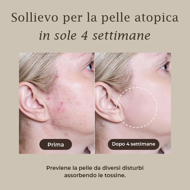 Maschera di fango di sollievo