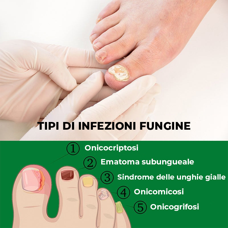 Trattamento unghie allo zenzero