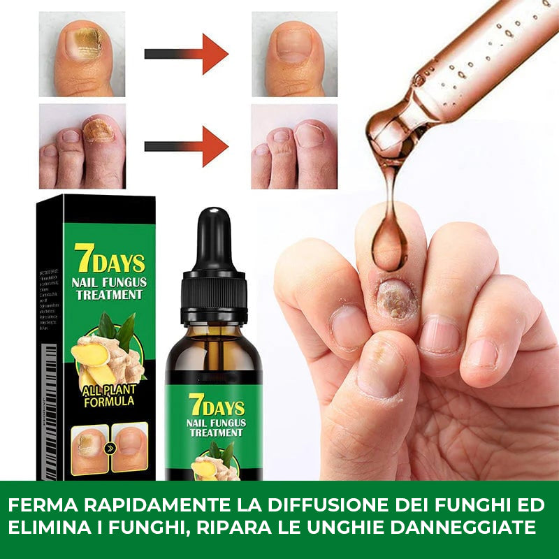 Trattamento unghie allo zenzero