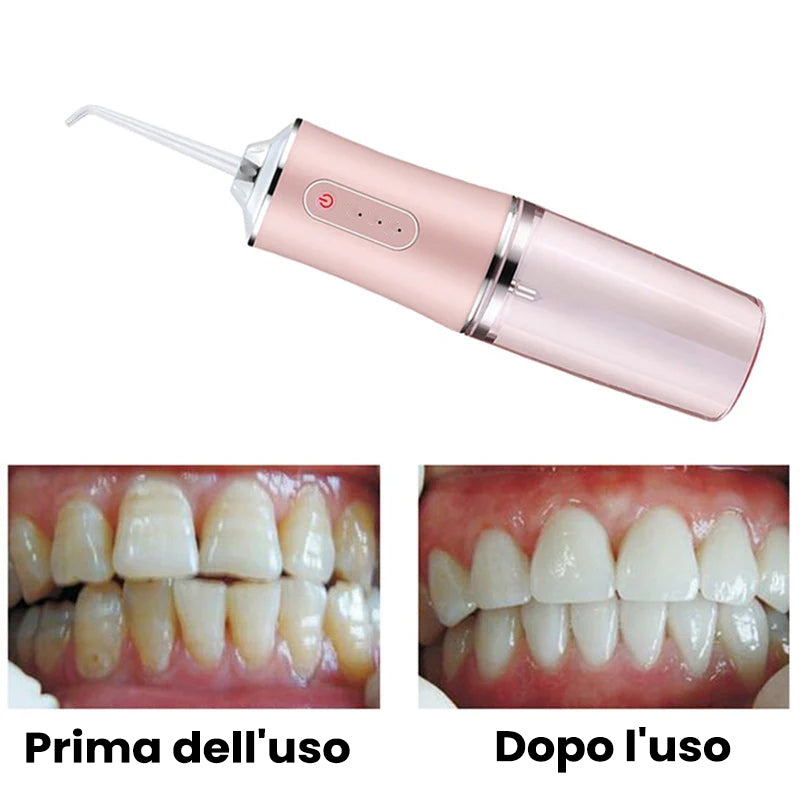 Idropulsore dentale portatile